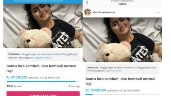 Profil Gaga Muhammad, Mantan Pacar Awkarin dan yang Disebut Buat Lumpuh Laura Anna