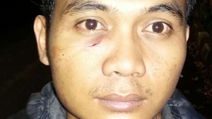 Terlalu, Bak Jagoan Kalap, Oknum Polisi Gebuki Wartawan TV One dan Mau Tembak Kaki Ko