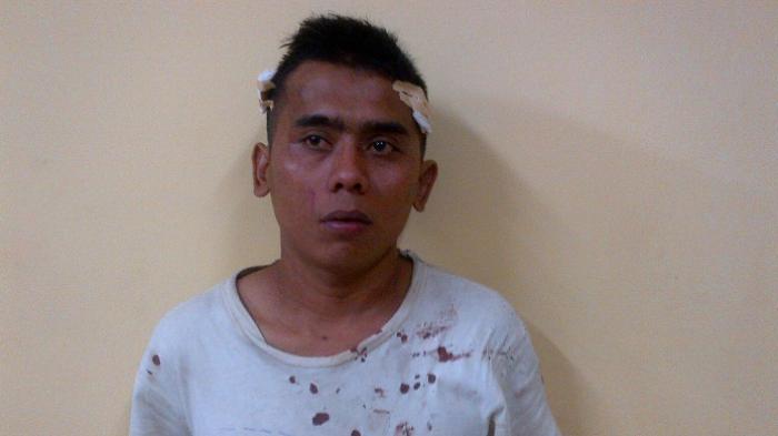 wawan-bonyok-dikeroyok-5-orang-di-panti-pijat