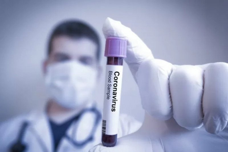 Pemerintah Indonesia Sudah Sediakan Obat Virus Corona 