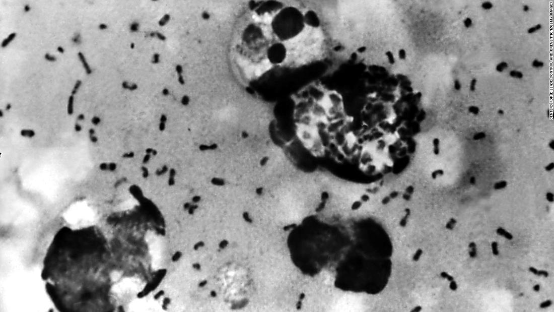 &#91;Pandemi&#93;Squirrel tests positive for bubonic plague in Colorado