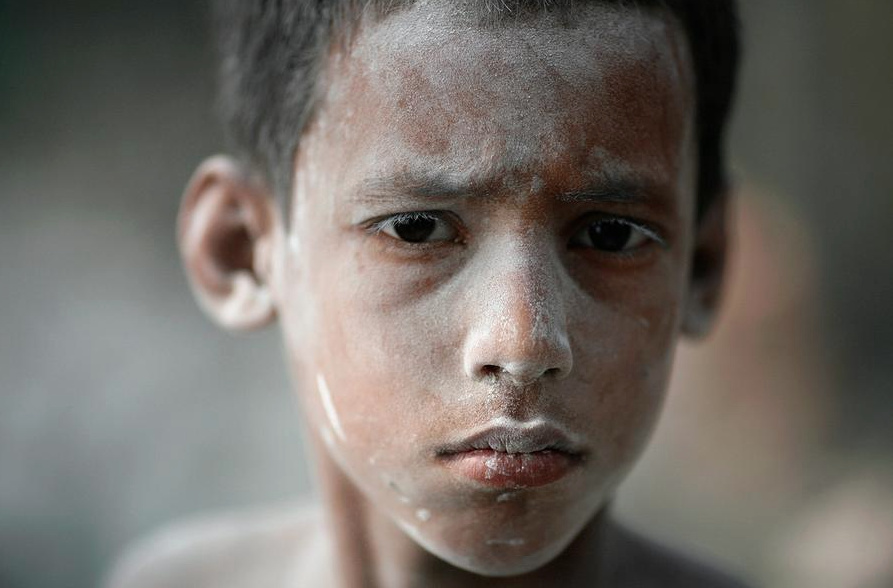 20 Foto Anak yang Dipekerjakan Secara Ilegal Ini Akan Mengubah Caramu Memandang Hidup