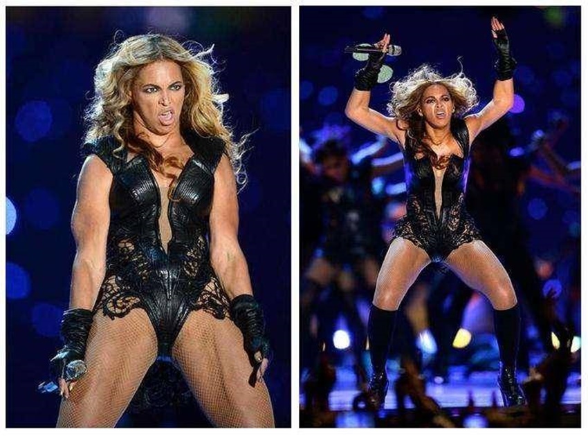 15 Foto Ini Buktikan Seleb Juga Manusia Biasa, Gak Selalu Cakep Setiap Saat