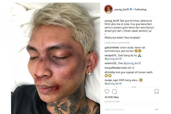 Young Lex Akui Wajahnya Babak Belur Hanya Riasan, Niatnya Prank