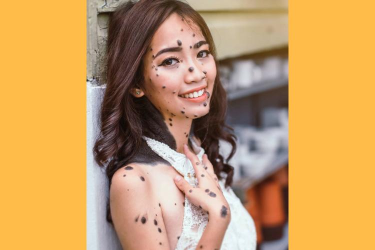 Inilah 9 Orang Dengan Keunikannya, Namun Tetap Terlihat Menawan!