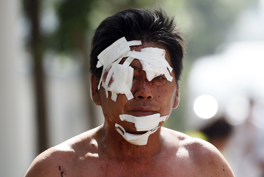 Aftermath Huge Explosion in Tianjin China 13 Agustus 2015