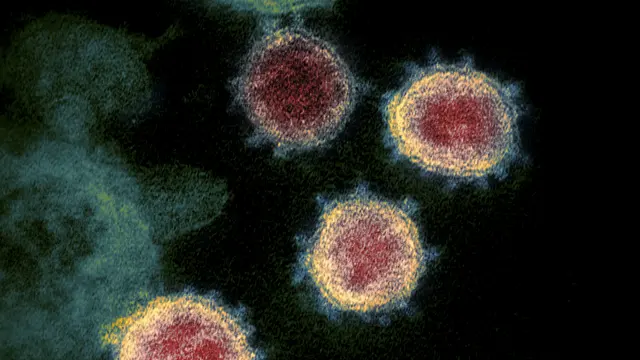 Riset: Virus Corona COVID-19 Kuat, Tangguh dan Tahan Panas Meski di Luar Inang