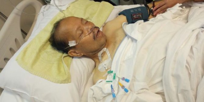 Mantan Politikus Demokrat Sutan Bhatoegana jatuh sakit