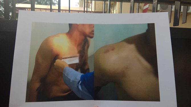 Axel babak belur, Polres Bandara bilang 'anak buah saya baik-baik'