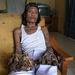 11 Manusia dengan wujud menyeramkan