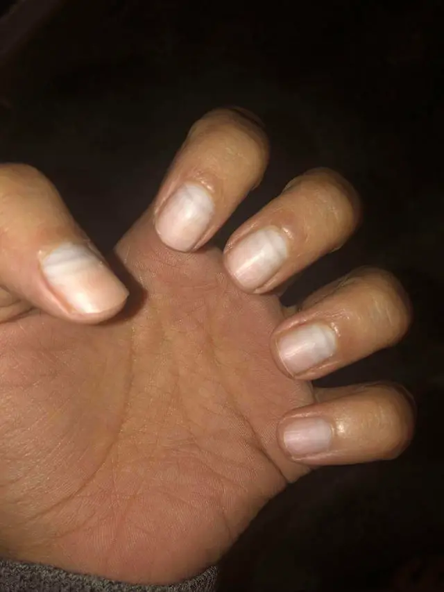 7 Foto Unik yang Ada di Dunia Ini, No 5 Bikin Ngilu