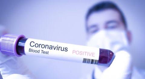 Tidak Pandang Bulu, Para Pesohor Ini Positif Terinfeksi Virus Corona