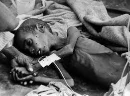 kasus-bencana-kelaparan-paling-parah-di-dunia