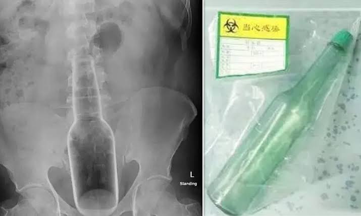 post-image