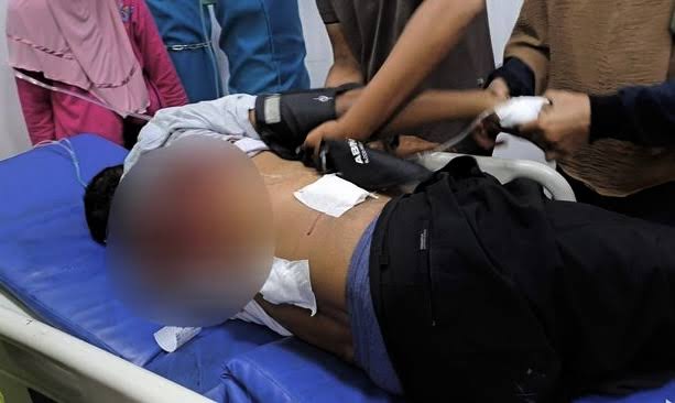 Polisi Sebut Relawan Prabowo di Sampang 2 Kali Ditembak Pria Bertubuh Kekar