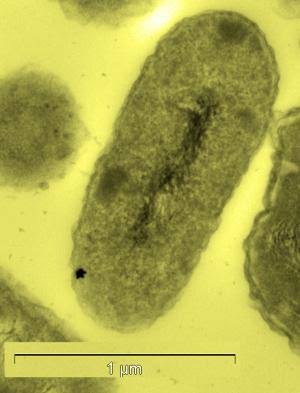 Bakteri Mengagumkan Mengubah Racun Jadi Emas Murni