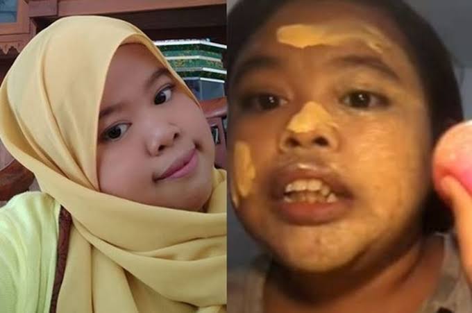 Kekeyi yang Dulu Panen Simpati, Sekarang Panen Hujatan