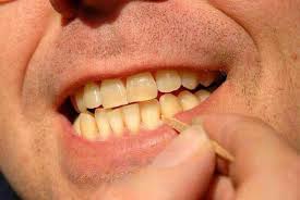 info-dan-konsultasi-mengenai-kesehatan-gigi