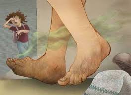 5 Hal Kenapa Nyamuk Suka Pada Anda