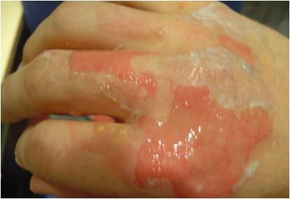 12 Ritual Kecantikan Paling Aneh
