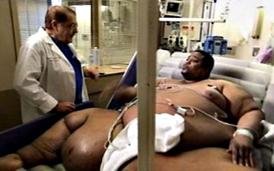 10 Orang Paling Gemuk Di Dunia 
