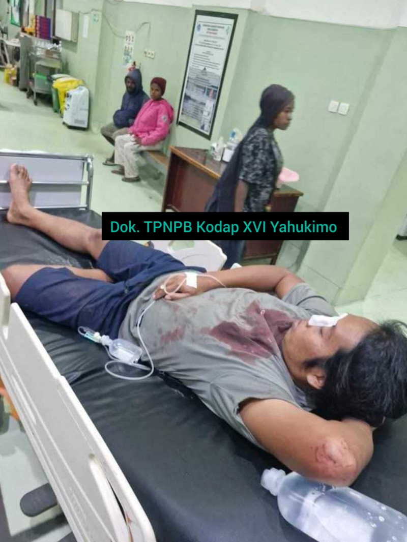 TPNPB OPM TPNPB Kodap XVI Yahukimo Klaim Tembak Perwira Polisi di Distrik Kurima