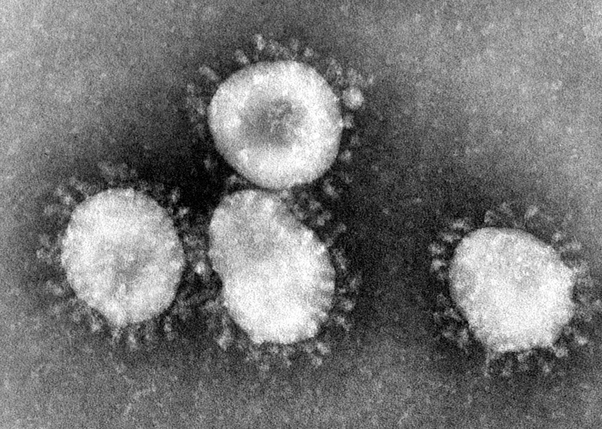 Lakukan 6 Langkah Berikut untuk Melindungi Diri dari Virus Corona...