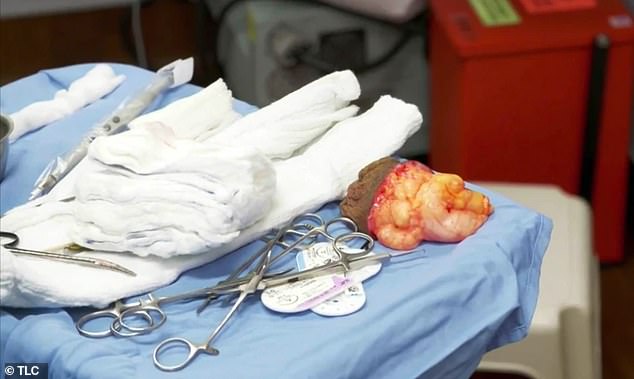 Merasa Tidak PD Saat Having Sex Dan Beraktivitas, Pria Ini Operasi Testis Ketiganya