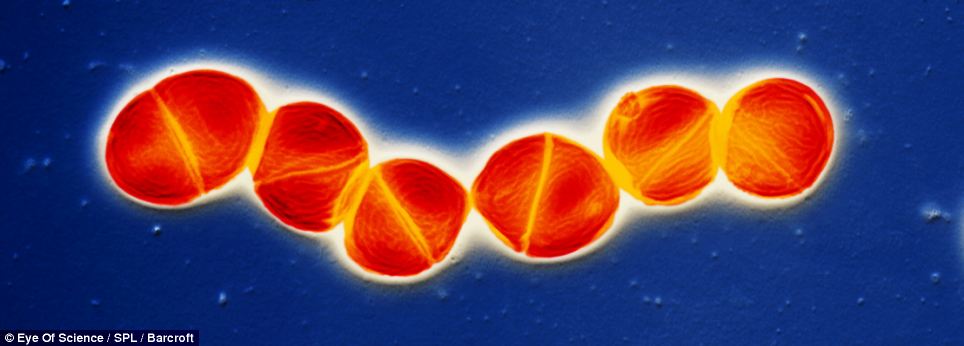 Gambar Langka Virus Paling Mematikan di Dunia!!!