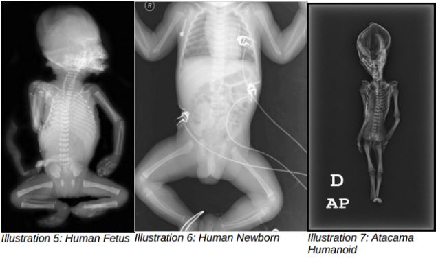 Terkuak! Misteri Fosil 'Alien' Berukuran 15 Cm Dari Chile
