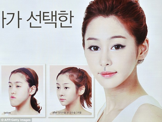 Wanita Korea, Terbanyak Operasi Plastik di Dunia