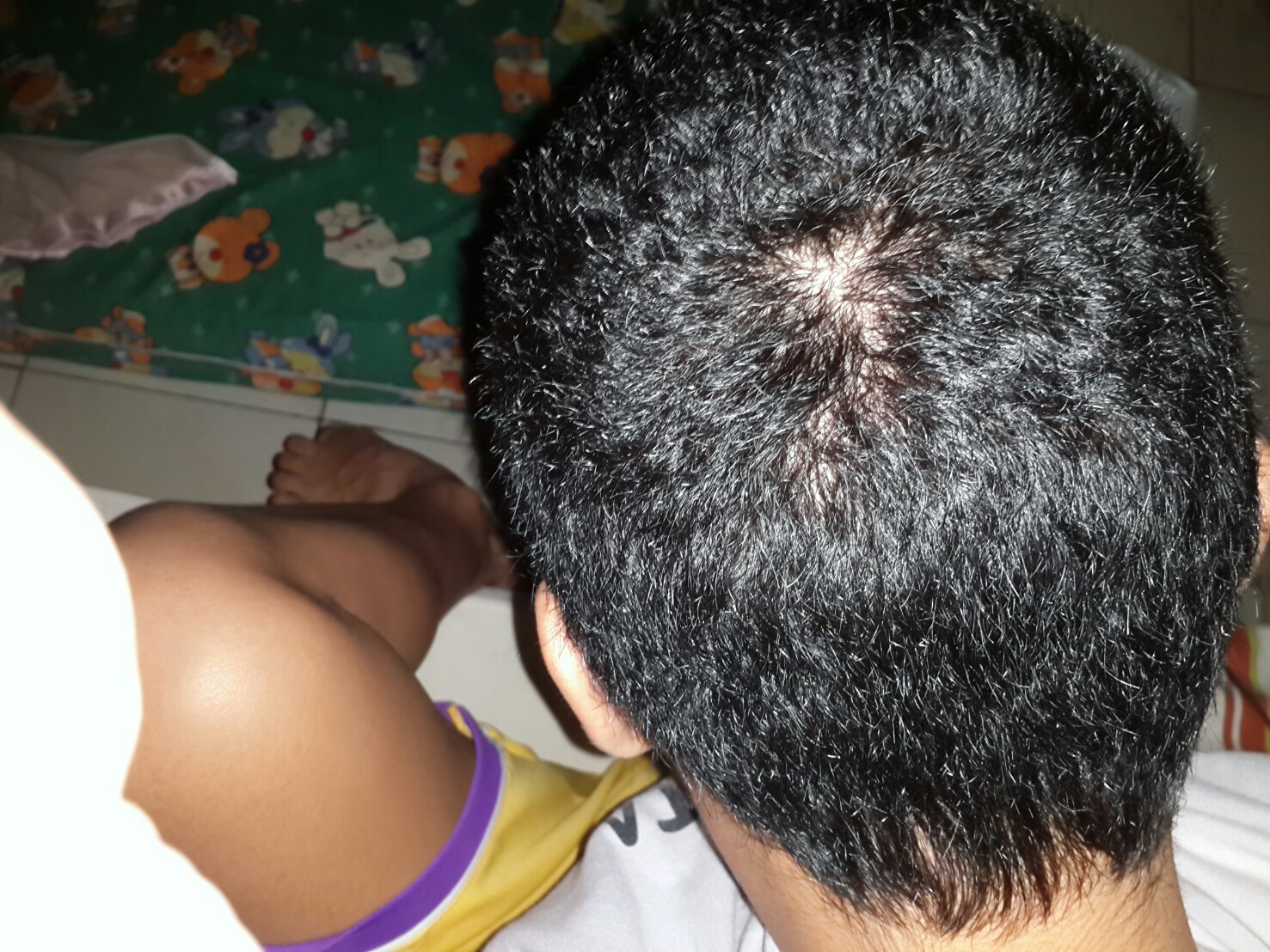 reborn-help-rambut-gua-rontok-hampir-botak