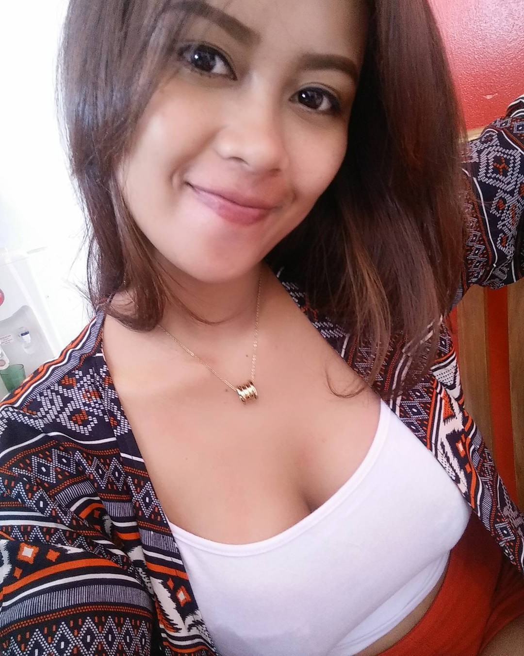 ALAMI OBESITAS SAMPAI CIDERA, WANITA INI SALAHKAN SUAMINYA