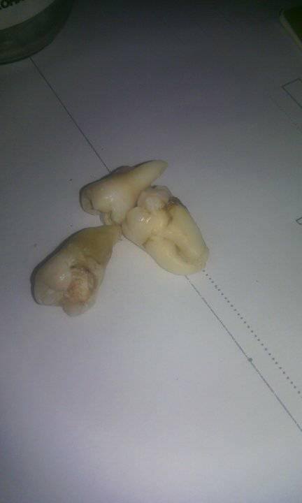 8-rahasia-kesehatan-mulut-dan-gigi-yang-wajib-semua-orang-tau