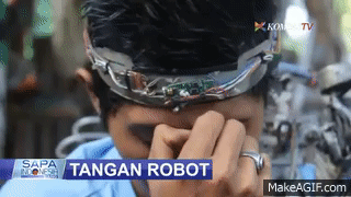 Saat tulang robot bantu anak lumpuh berjalan pertama kali