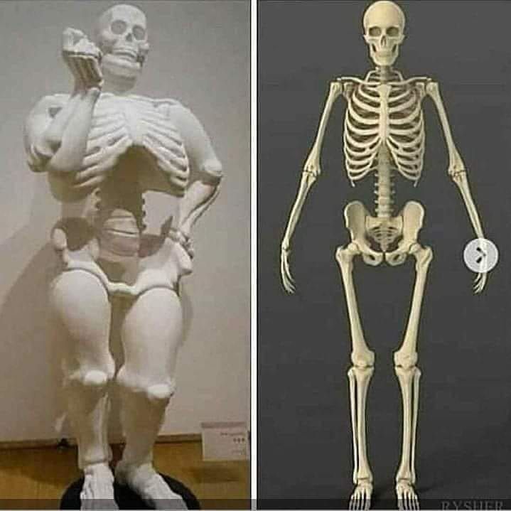 Apa Iya Tulang Orang Gemuk Lebih Besar Dari Orang Normal? Fakta Gak Sih?