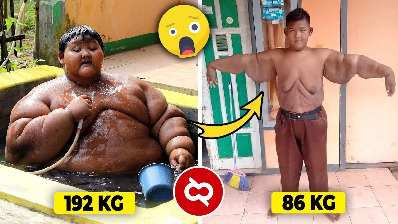 Apa Iya Tulang Orang Gemuk Lebih Besar Dari Orang Normal? Fakta Gak Sih?