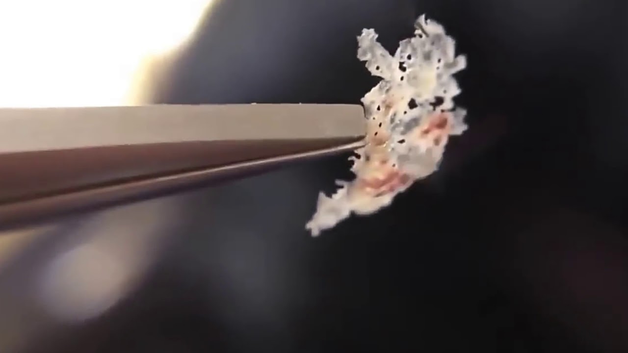 ada-yg-belum-tau-ketombe-masuq-aja-gan