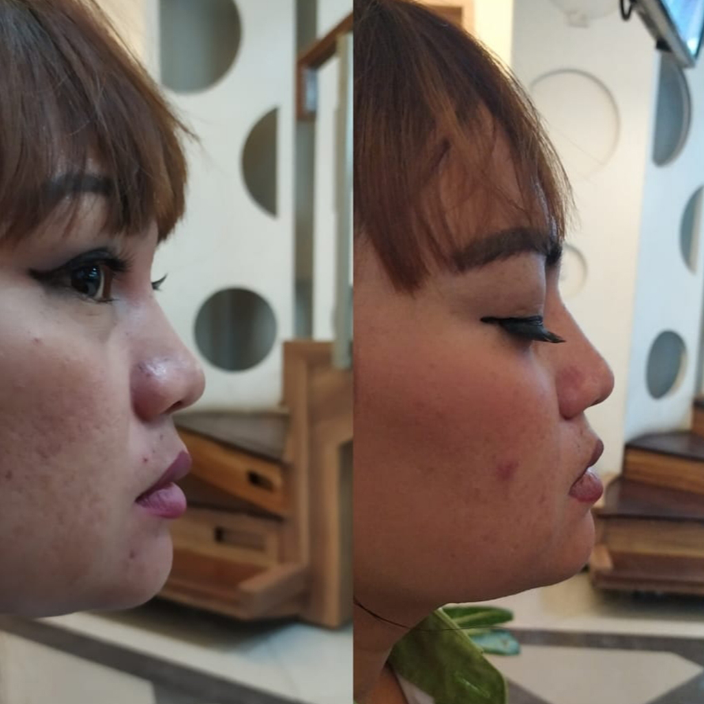 Mau Kulit Tetap Awet Muda?
