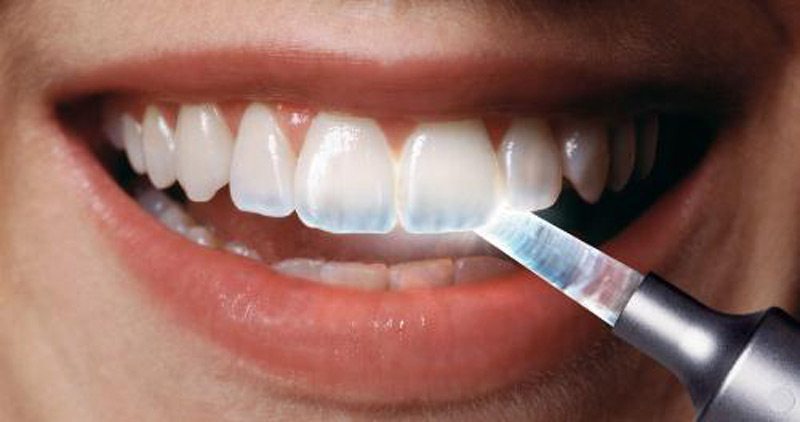 Inilah Fakta Tentang Gigi Manusia Yang Belum Banyak Orang Tahu !