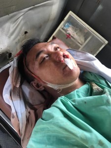 Diduga OD, Oknum TNI Tewas di Binjai