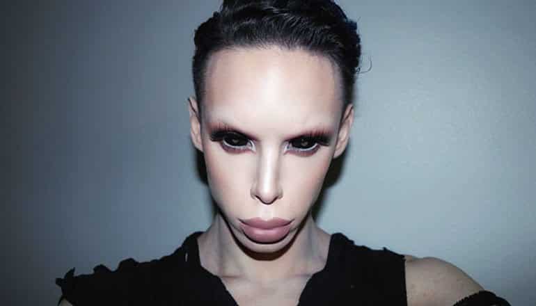 Pria Ini Melakukan 100 Kali Operasi Plastik Agar Mirip Alien, Tertarik Coba?
