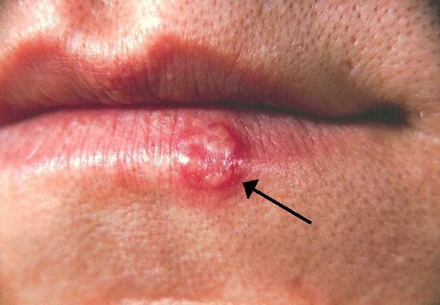 Waspada! Ini Dia 7 Virus Paling Mematikan di Dunia