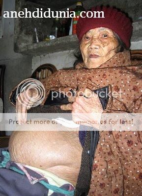 Nenek 60 Tahun Melahirkan Bayi Mumi &#91;FOTO&#93;