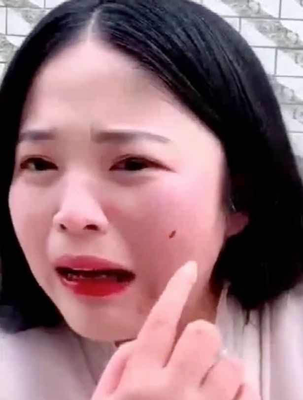 Pamer Aksi Makan Gurita Hidup-hidup, Perempuan Ini Alami Hal Mengerikan