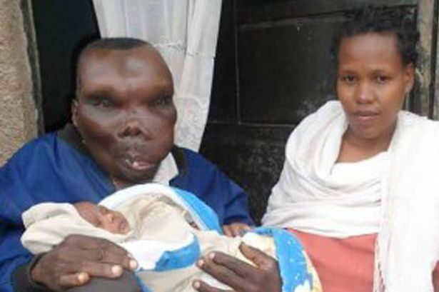 Pria Terjelek di Uganda, 2 kali Kawin & punya banyak Anak, Mantaabb..