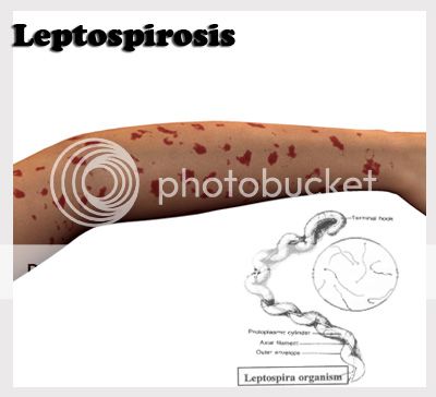 hati-hati-minum-minuman-kemasan-kaleng-bisa-kena-leptospirosis