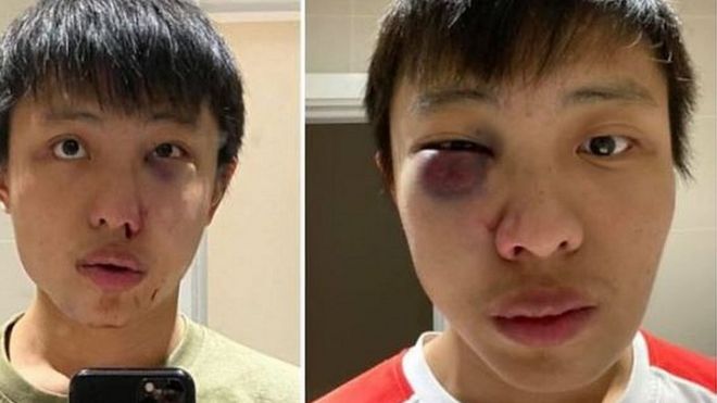 Saya tidak ingin virus coronamu di negaraku Mahasiswa Singapura alami srangan rasisme