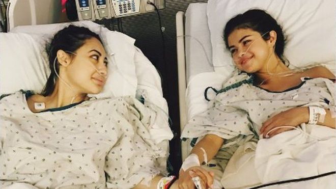 Mengenal Penyakit Lupus Yang Diderita Selena Gomez