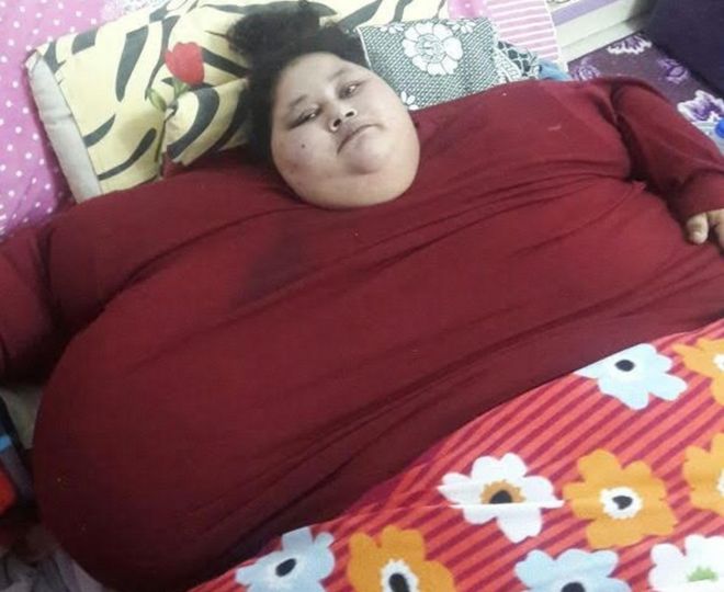 Diam Selama 25 Tahun di Rumah, Berat Badan Wanita Ini Capai 500 Kg